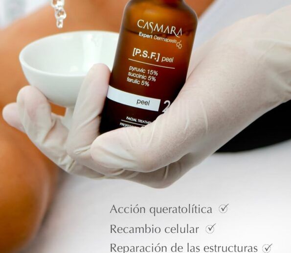 Peeling Quimico 1 595x516