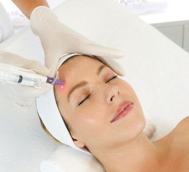 microneedling age reverse