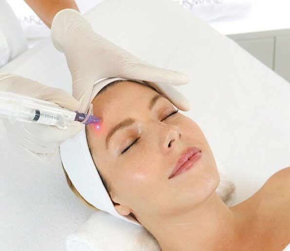 Microneedling age reverse microneedling age reverse