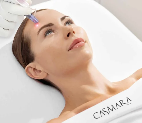 portada_casmara woman receiving a facial laser treatment on the forehead, with a clinician's gloved hand holding a laser device.
